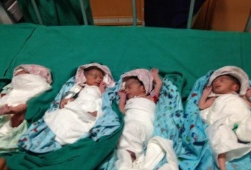 धनगढीकी एक महिलाले जन्माइन् ४ चम्ल्याहा शिशु